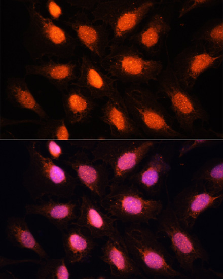 Immunofluorescence analysis of U2OS cells using TERF2IP Polyclonal Antibody at dilution of 1:100. Blue: DAPI for nuclear staining.