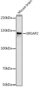 Western blot analysis of extracts of various cell lines using SRGAP2 Polyclonal Antibody at 1:1000 dilution.