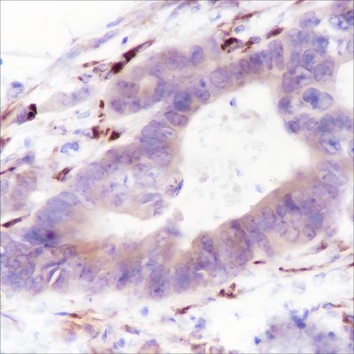 Recombinant Thymidylate Synthase Monoclonal Antibody - small - 2