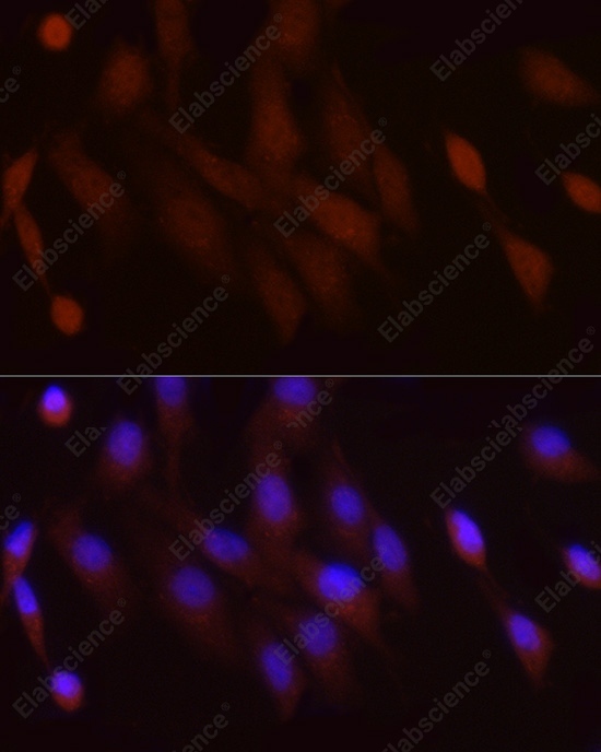 PGC1 alpha Polyclonal Antibody - 6