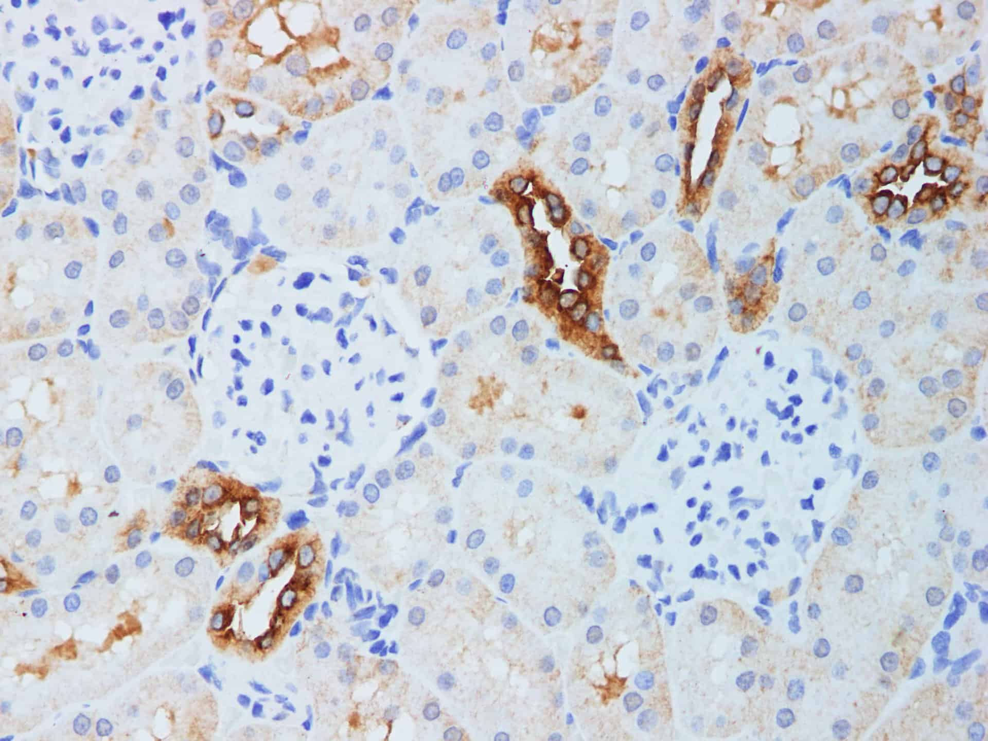 Immunohistochemistry of paraffin-embedded Rat kidney using KLK10 Polyclonal Antibody Antibody at dilution of 1:200(1?400)