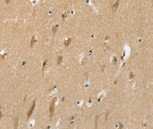 Immunohistochemistry of paraffin-embedded Human brain tissue using SLC6A7 Polyclonal Antibody at dilution 1:30