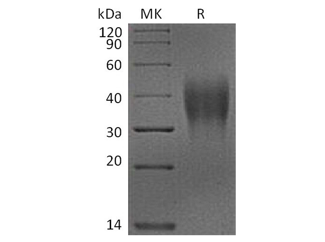 Recombinant Cynomolgus VSIR Protein (His Tag)