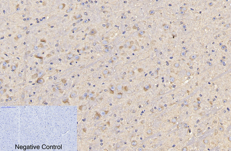 Immunohistochemistry of paraffin-embedded Mouse brain tissue using CD4 Monoclonal Antibody at dilution of 1:200.