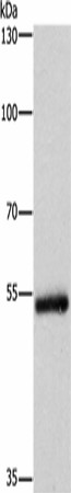 Western Blot analysis of Human colon cancer tissue using CYP2B6 Polyclonal Antibody at dilution of 1:400