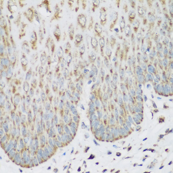 Immunohistochemistry of paraffin-embedded Human esophagus using IGF2BP3 Polyclonal Antibody at dilution of  1:200 (40x lens).