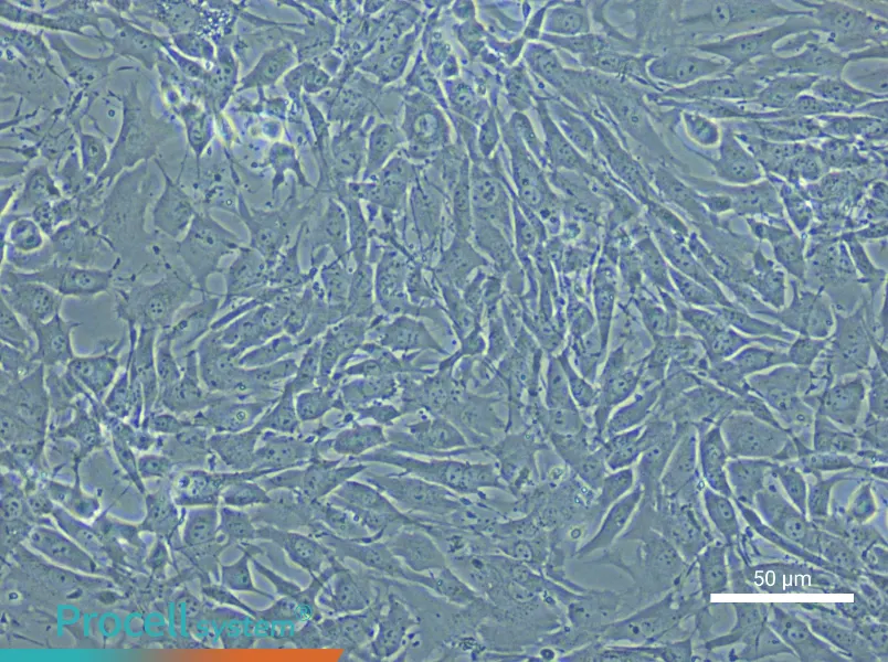Mouse Pulmonary Great Artery Smooth Muscle Cell Complete Medium - small - 6