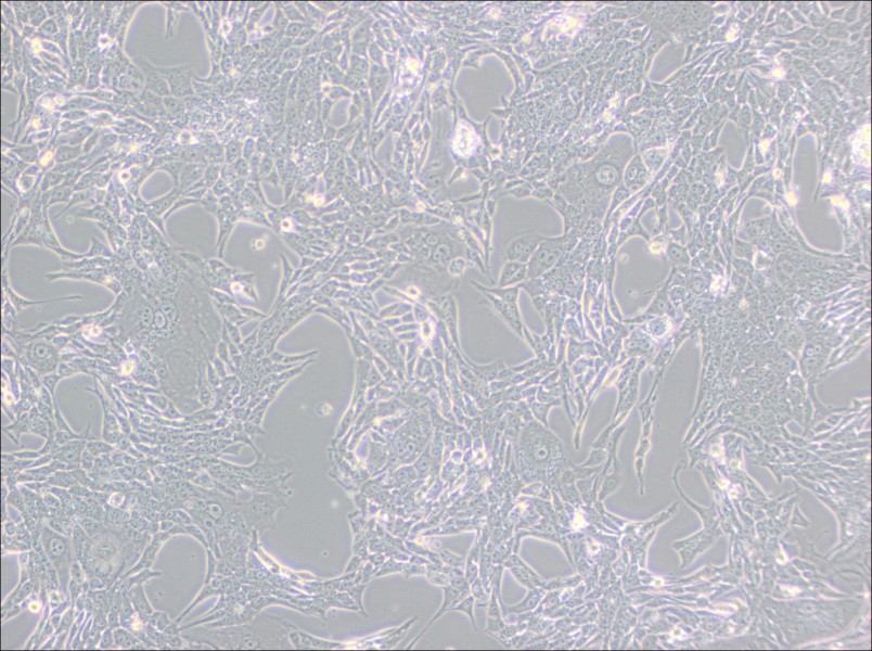 Renca [RenCa] Cell Complete Medium - small - 4