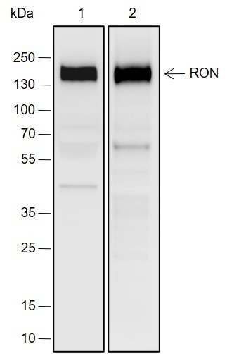 Recombinant RON Monoclonal Antibody-searchlist-1