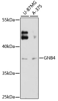 Western blot analysis of extracts of various cell lines using GNB4 Polyclonal Antibody at 1:3000 dilution.