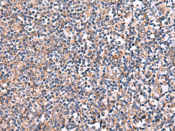 Immunohistochemistry of paraffin-embedded Human tonsil tissue  using INPP5B Polyclonal Antibody at dilution of 1:40(?200)