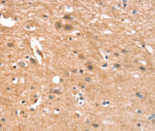 Immunohistochemistry of paraffin-embedded Human brain  tissue using CYLD Polyclonal Antibody at dilution 1:35