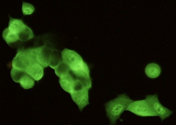 Recombinant STUB1 Monoclonal Antibody - small - 2
