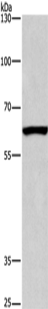 Western Blot analysis of Mouse testis tissue using ARMCX2 Polyclonal Antibody at dilution of 1:425