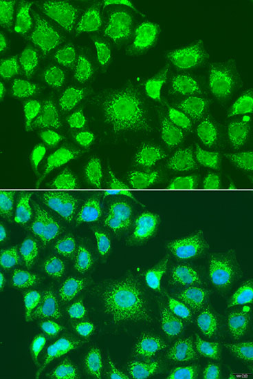 Immunofluorescence analysis of U2OS cells using ATG4D Polyclonal Antibody at dilution of  1:100. Blue: DAPI for nuclear staining.