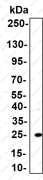 Recombinant Thymidine Kinase Monoclonal Antibody - 3