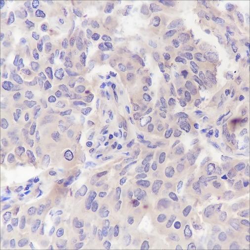 Recombinant PRMT5 Monoclonal Antibody - 2