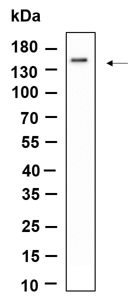 Recombinant SMC3 Monoclonal Antibody-searchlist-1