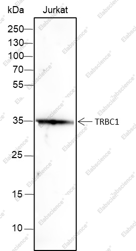 Recombinant TRBC1 Monoclonal Antibody - 1