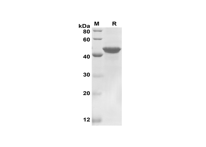 Recombinant Human PD1 Protein(His Tag)-产品推荐-1