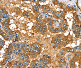 PYGL Polyclonal Antibody - 2