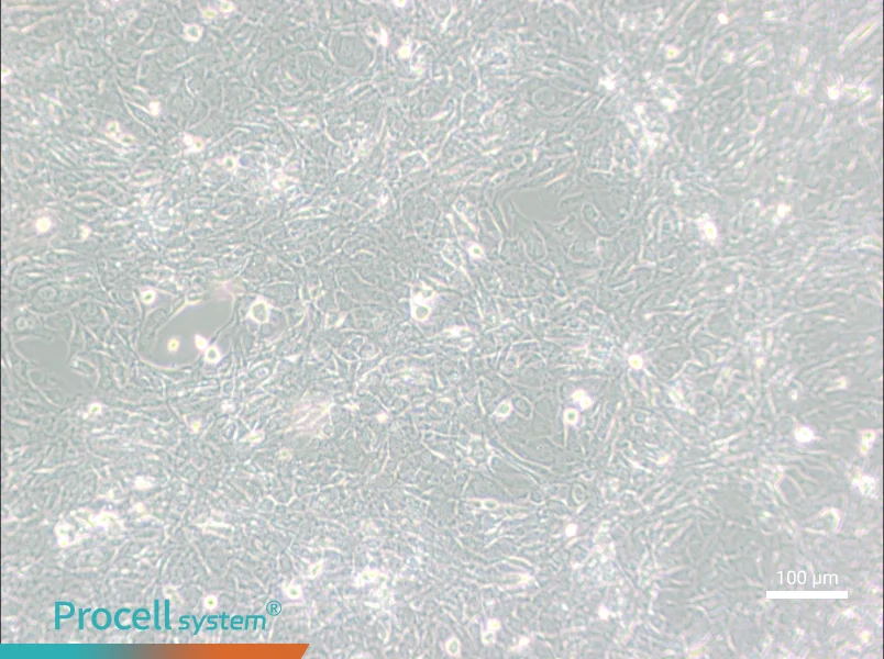 15P-1 Cell Complete Medium - 2