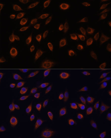 Immunofluorescence analysis of L929 cells using NTPCR Polyclonal Antibody at dilution of  1:100. Blue: DAPI for nuclear staining.