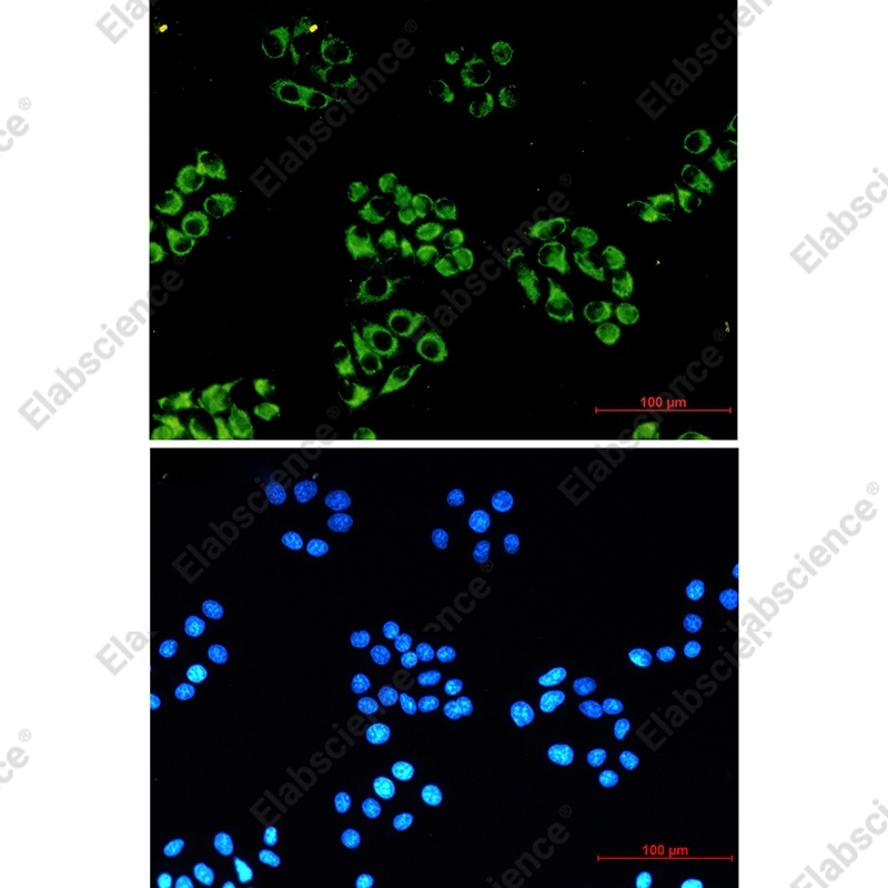 Recombinant NDUFB10 Monoclonal Antibody - 2