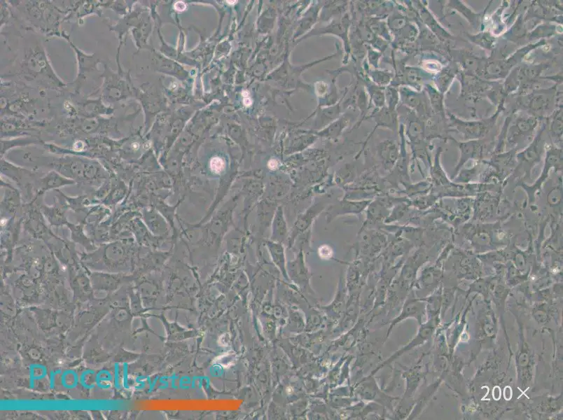 Tb 1 Lu Cell Complete Medium - 4