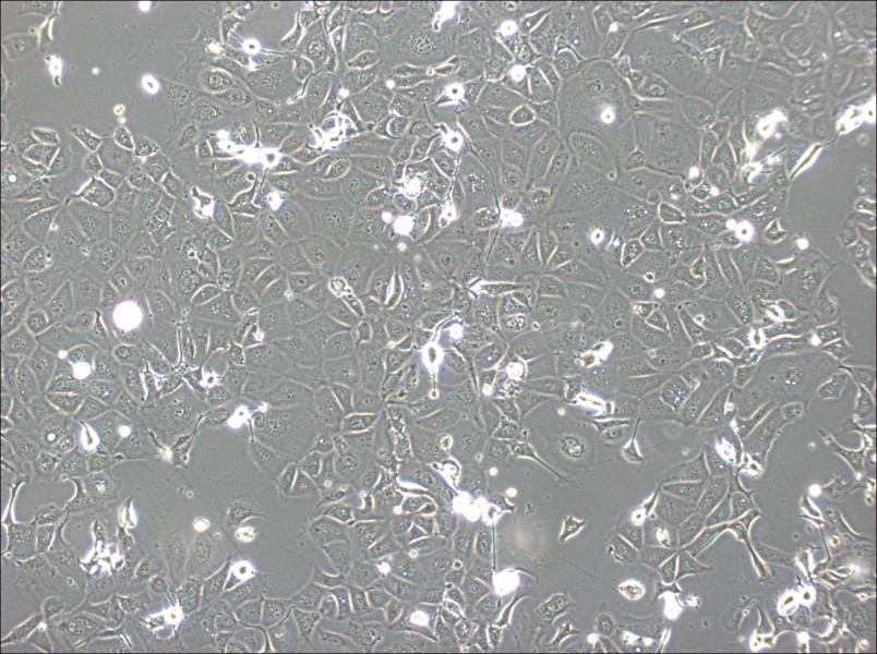 NCI-H1693 Cell Complete Medium - 3