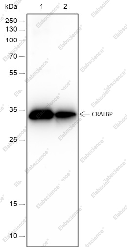 Recombinant CRALBP Monoclonal Antibody - 1