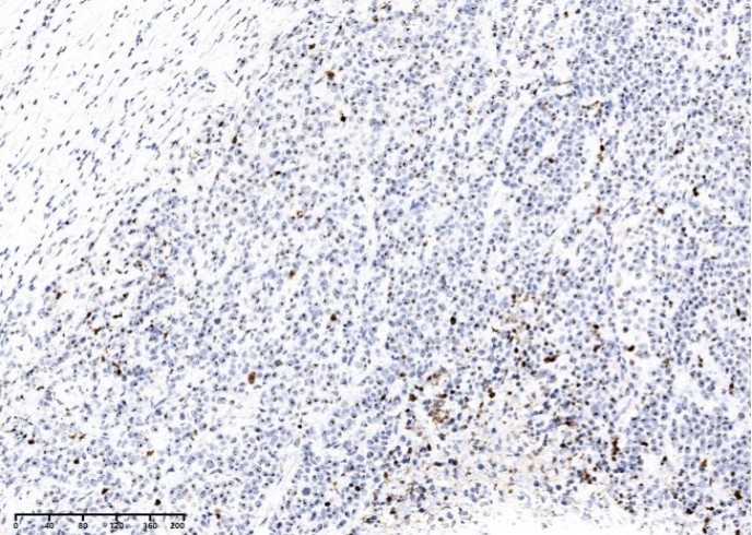 PARP-1 Monoclonal Antibody - small - 2