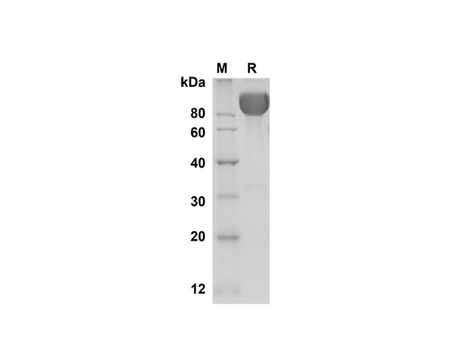 Recombinant Mouse TNFR1/TNFRSF1A Protein(His Tag)-产品推荐-1