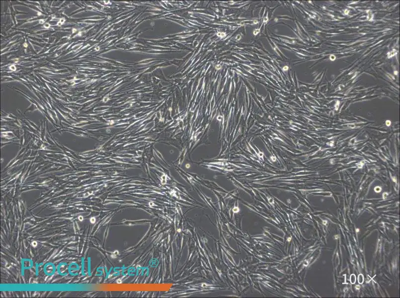 MeWo Cell Complete Medium - 2