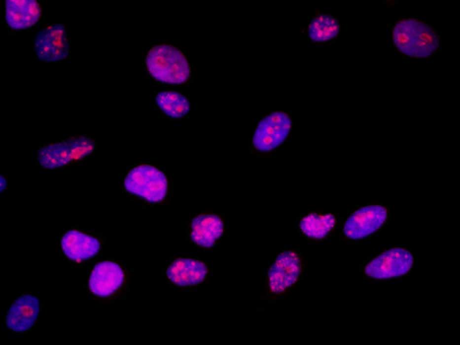 Purified Anti-Human CD193 Antibody[5E8]-产品推荐-1