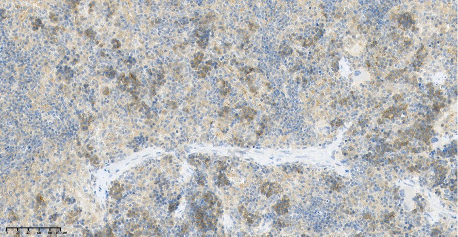 Recombinant TBK1 Monoclonal Antibody - 2