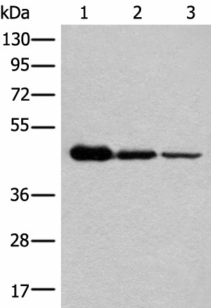 Western blot analysis of HEPG2 Hela and A549 cell lysates  using NADK2 Polyclonal Antibody at dilution of 1:600