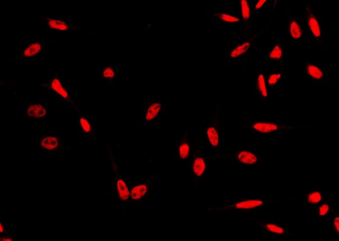 Recombinant HSF1 Monoclonal Antibody-searchlist-1