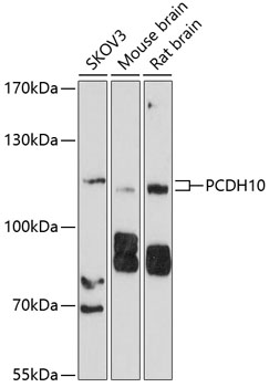 Western blot analysis of extracts of various cell lines using PCDH10 Polyclonal Antibody at 1:1000 dilution.