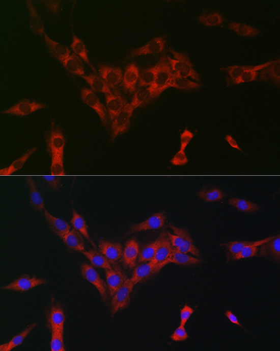 Immunofluorescence analysis of C6 cells using eIF4A Polyclonal Antibody at dilution of 1:100 (40x lens). Blue: DAPI for nuclear staining.