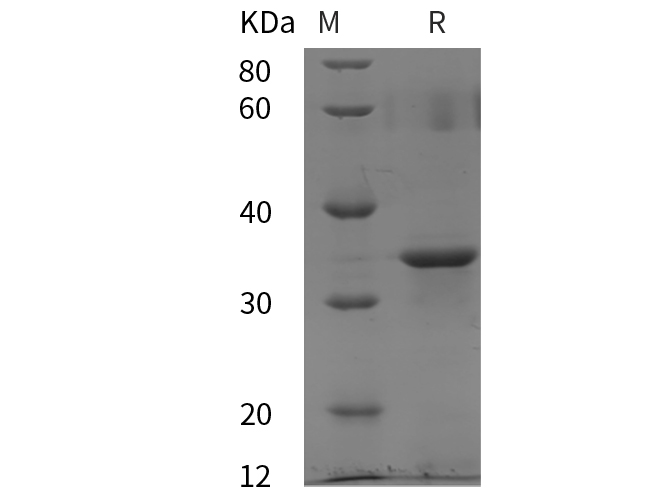 Recombinant mouse TGF-beta 2/TGFB2 Protein(His Tag)-产品推荐-1