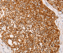 AK2 Polyclonal Antibody - 2