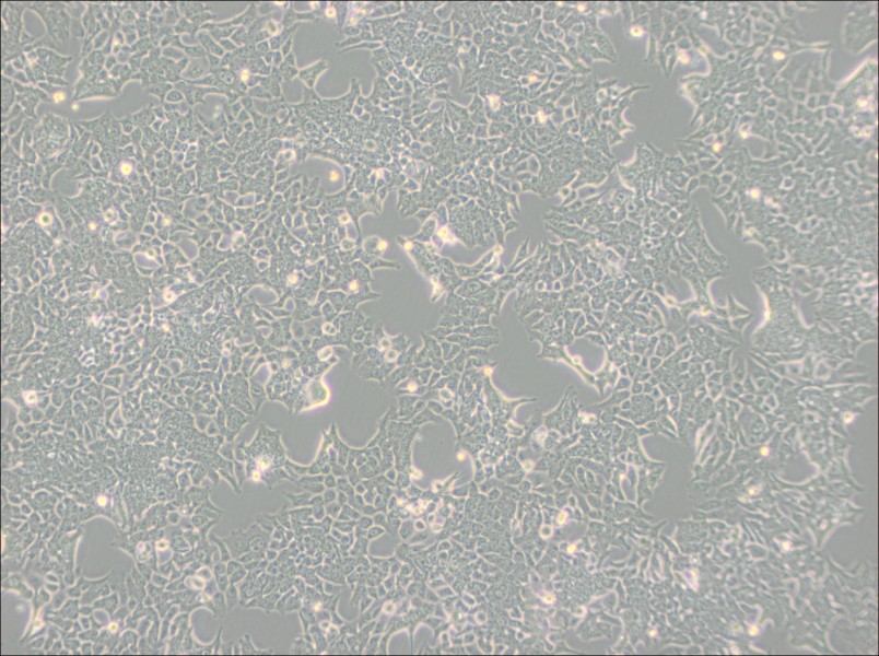 HCT 116 Cell Complete Medium - 3