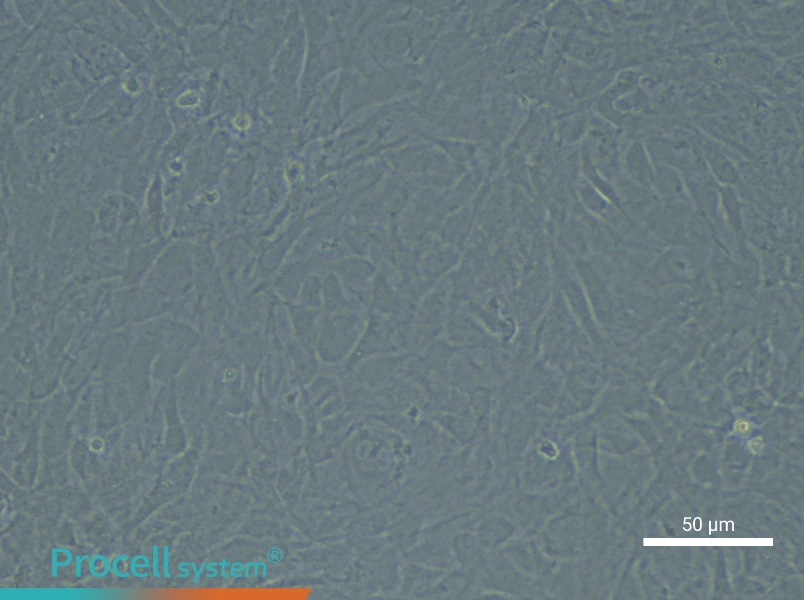 Rat Bronchial Fibroblast Complete Medium - 5