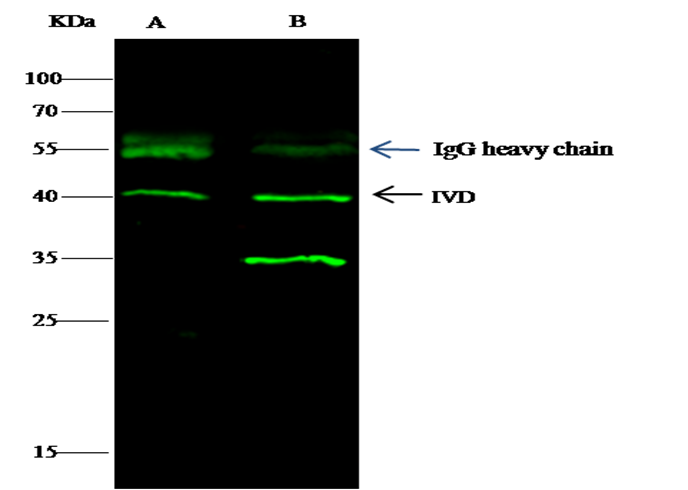 Isovaleryl-CoA dehydrogenase/IVD Monoclonal Antibody - small - 3