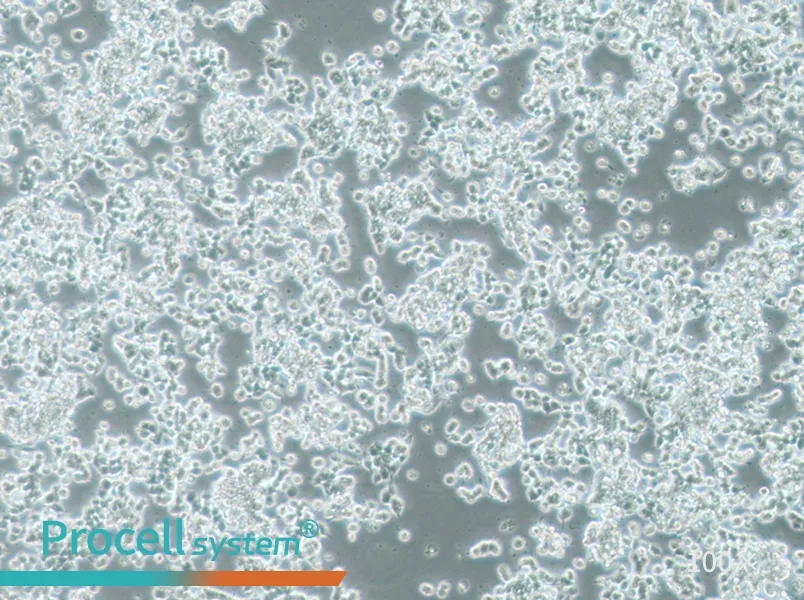 SK-NEP-1 Cell Complete MediumSK-NEP-1 Cell Complete Medium - 2