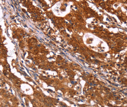 ABI1 Polyclonal Antibody - 3