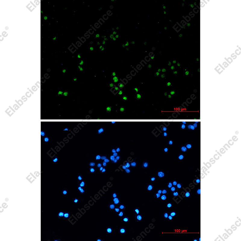 Recombinant ZHX2 Monoclonal Antibody - 2