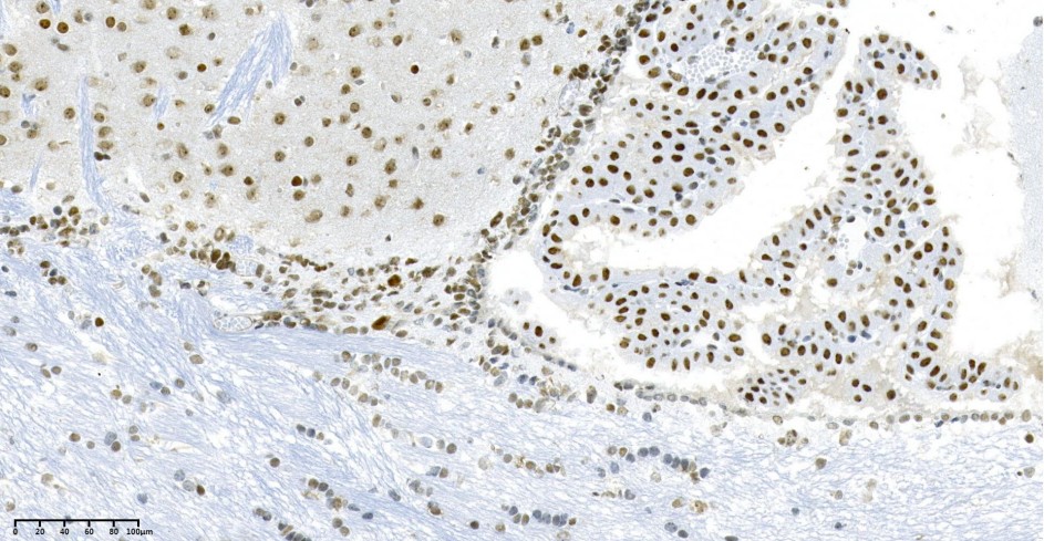 Recombinant HP1α Monoclonal Antibody - small - 2