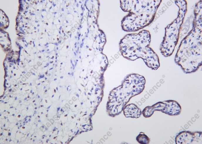 Recombinant STK3 Monoclonal Antibody - 2